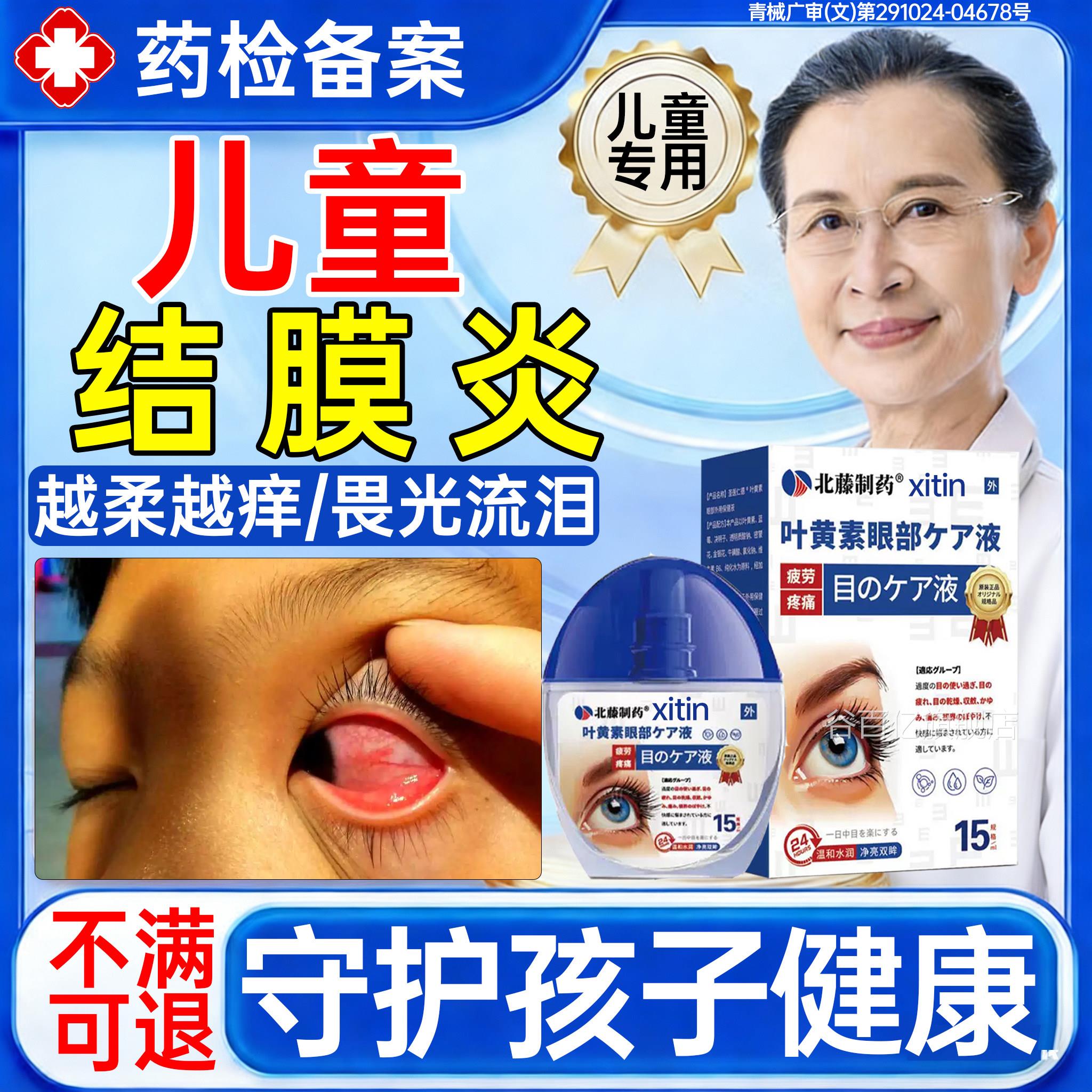 痒儿童过敏性结膜炎滴眼液专用眼水眼皮红肿眼睛周围发痒畏光PP谷