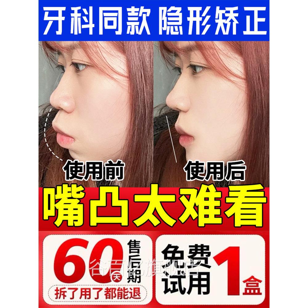 防嘴凸下颚下巴缩矫正器非神器成人儿童龅牙地包后天大小脸牵引器
