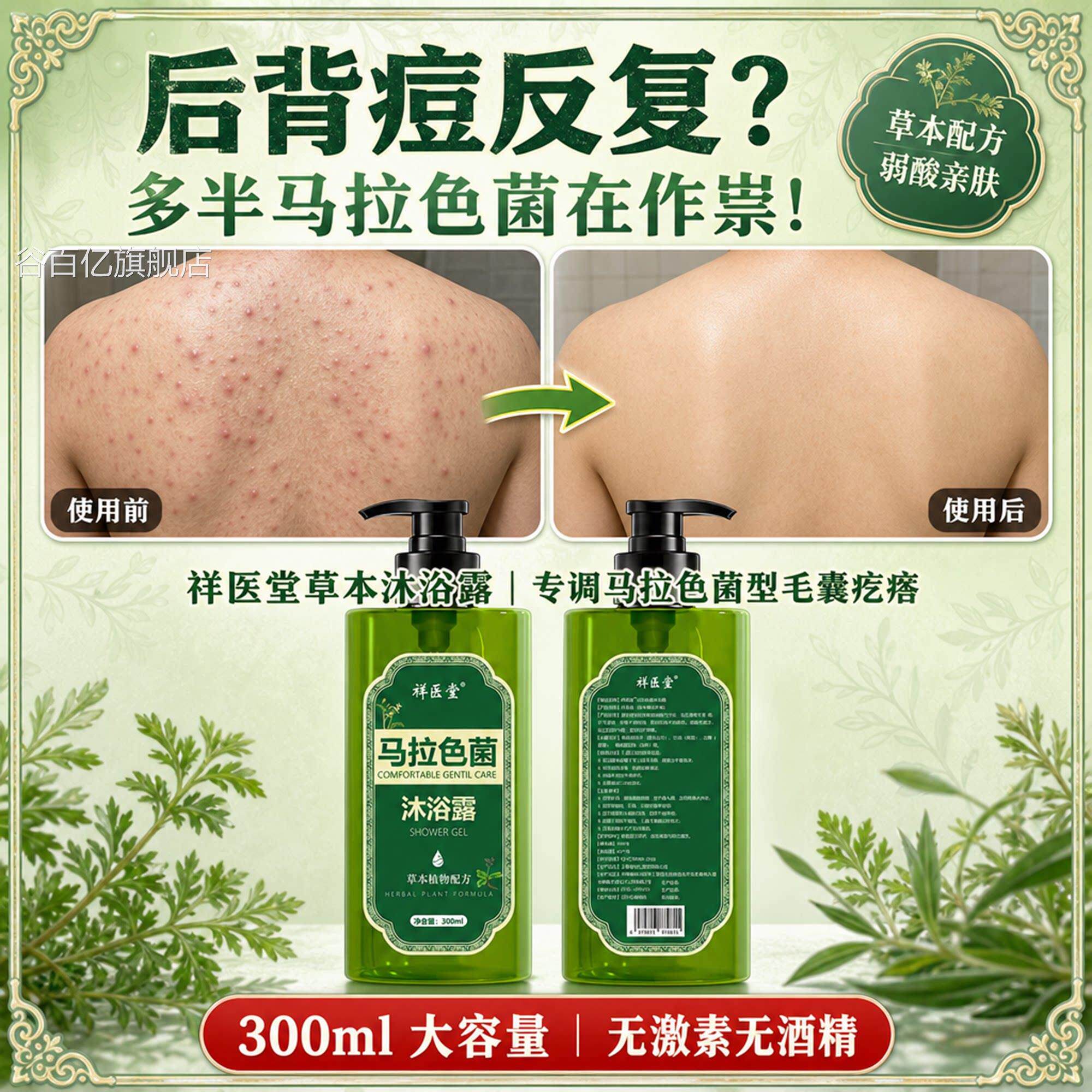 祥医马拉色菌沐浴露前胸后背部祛痘毛囊炎沐浴露专用官方旗堂舰店