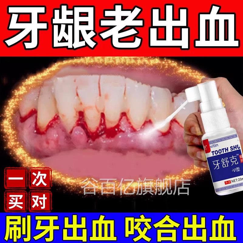 云南白药牙膏牙周炎牙龈出血专用牙膏喷剂牙龈消脓包肿痛炎脱敏UU