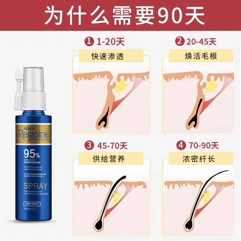 落健头发增长液脂溢性秃顶斑秃男女发际线快速增长精华液固发神器