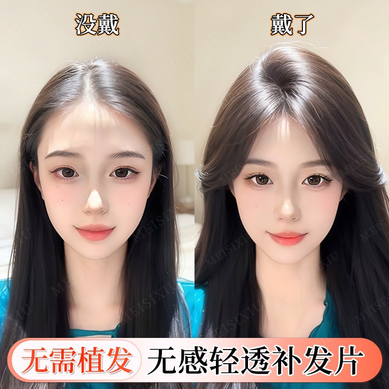假刘海女片头顶仿真人发高颅顶自B然前额蓬松增发量发际线贴假发