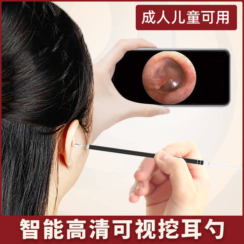 发光采耳镜可视挖耳勺手机版专业耳勺