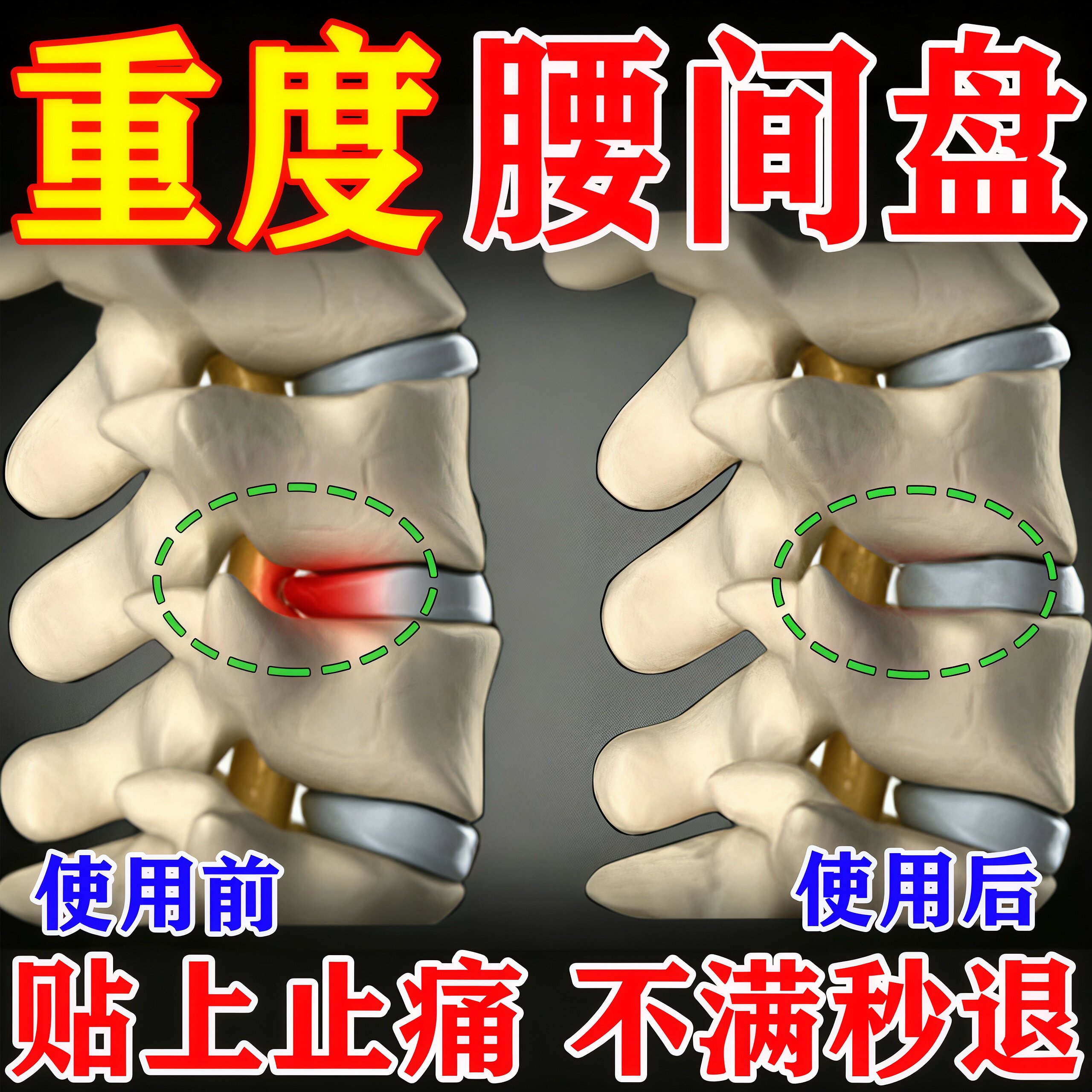 【腰间盘克星】远红外贴不满可退
