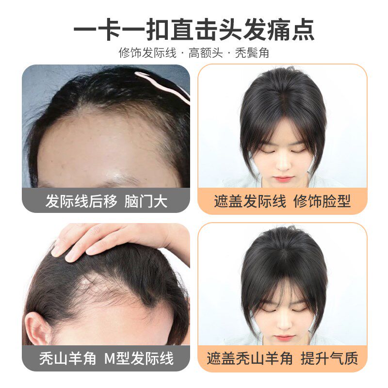 胎毛刘海假发片女头顶自然前额全真发轻薄隐形无痕假刘海发际线贴