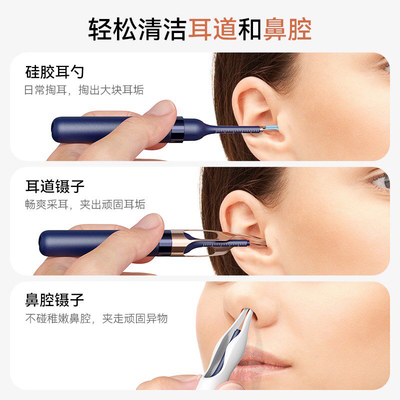 sunuo素诺可视掏耳勺高清挖耳勺镊子儿童掏耳朵神器采耳工具套装