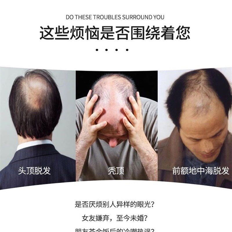 男士假发短发真人发丝补发片隐形无痕生物补发块男人寸头透气轻薄