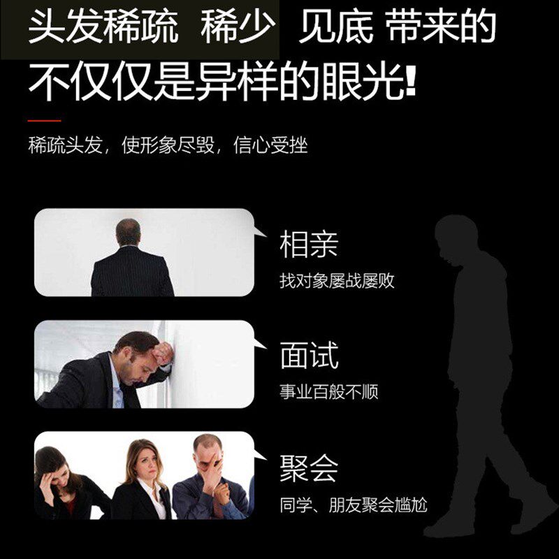 密发增发纤维粉头发变浓密遮秃头顶填充粉补发神器假发美发粉喷雾