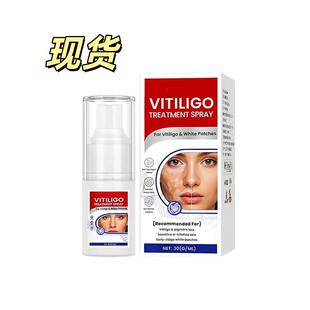 Vitiligo Treatment Spray 皮肤喷雾 温和呵护肌肤