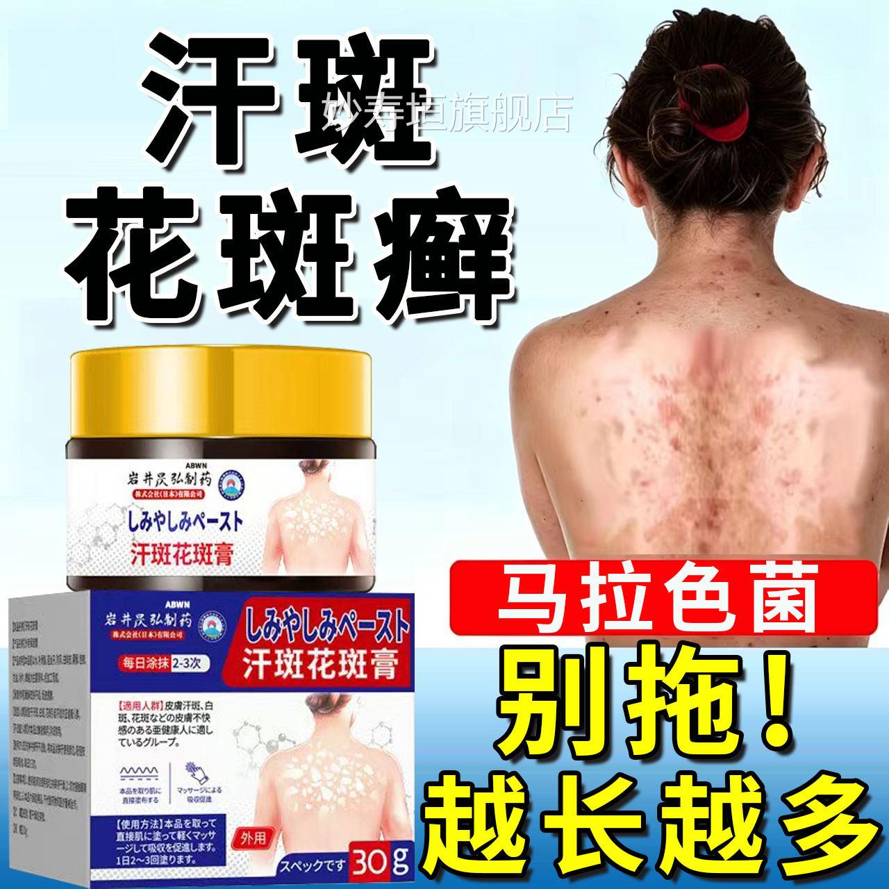 汗斑花斑癣专膏用除白斑褐斑真菌马拉色菌去感染癣后背消LL妙寿垣