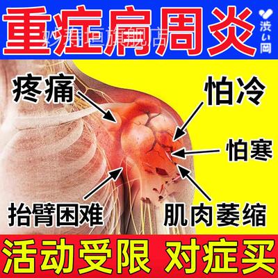 涩舰冈肩周炎专用贴膏特效旗店远红外肩周炎痛贴暖宝宝理疗仪UU妙
