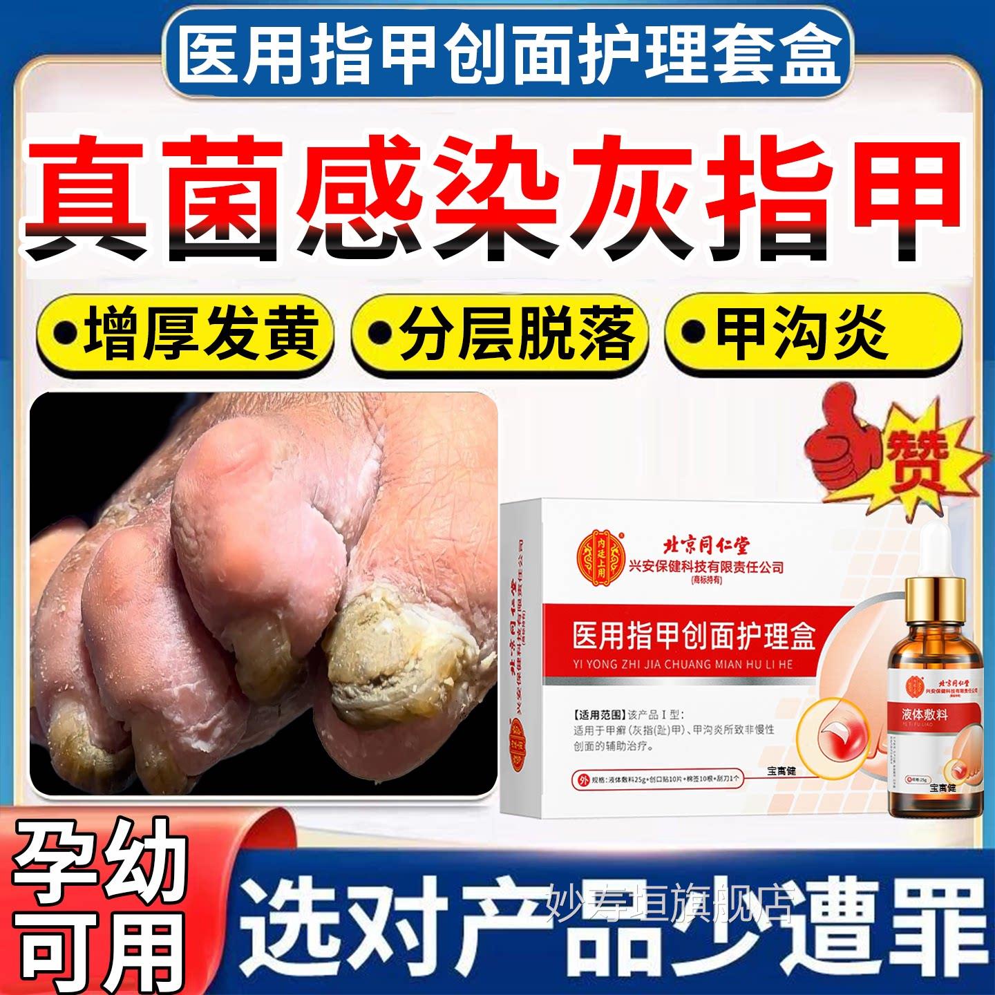 孕妇灰指甲特药水效一滴净脚指甲液增厚用什么药变黄灰甲神器真菌