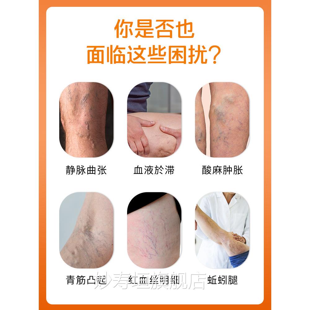 涩冈脉曲张腿部青筋静凸起蚯蚓腿血管肿胀红血丝医用凝胶dj妙寿垣