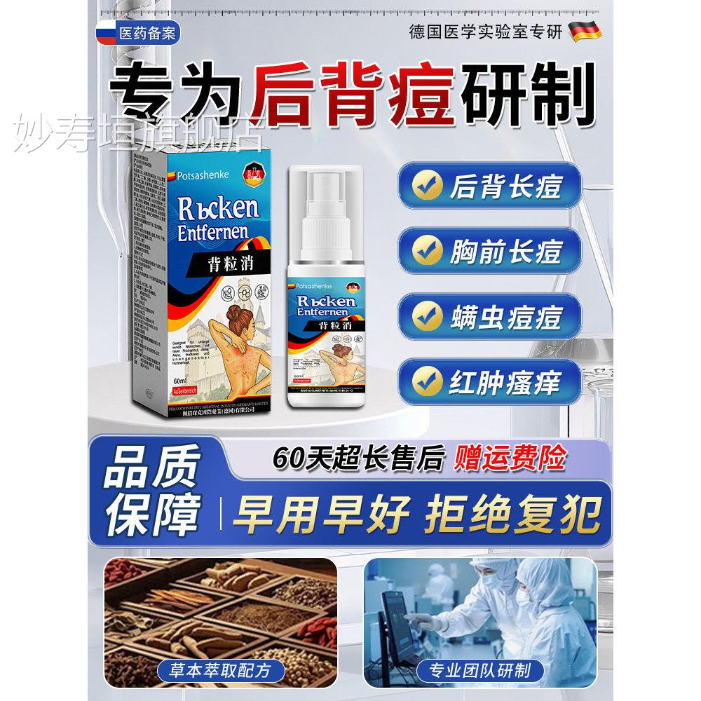 马拉色菌前胸后背痘痘除去除喷雾身体毛囊螨祛痘痒炎背上痘痘神器