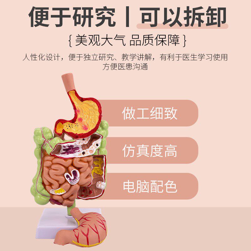 教学仿真人d体大肠病理模型 肠胃 大肠病变 肠道疾病 结肠病变模
