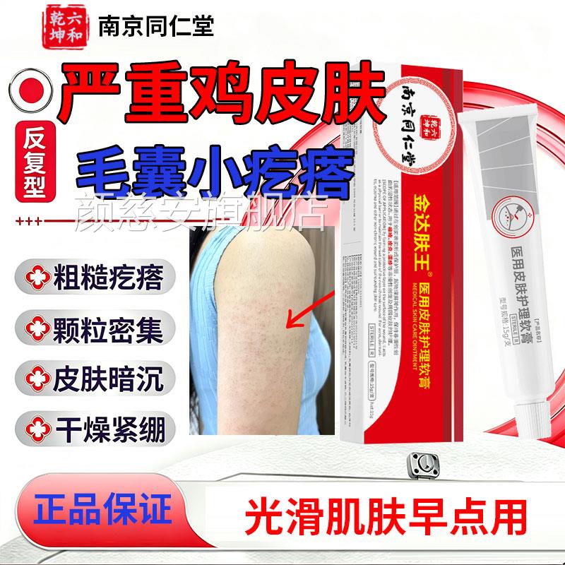 手臂毛囊炎胳膊上长疙鸡皮肤去除角瘩化症专用长痘痘除螨祛痘痒颜