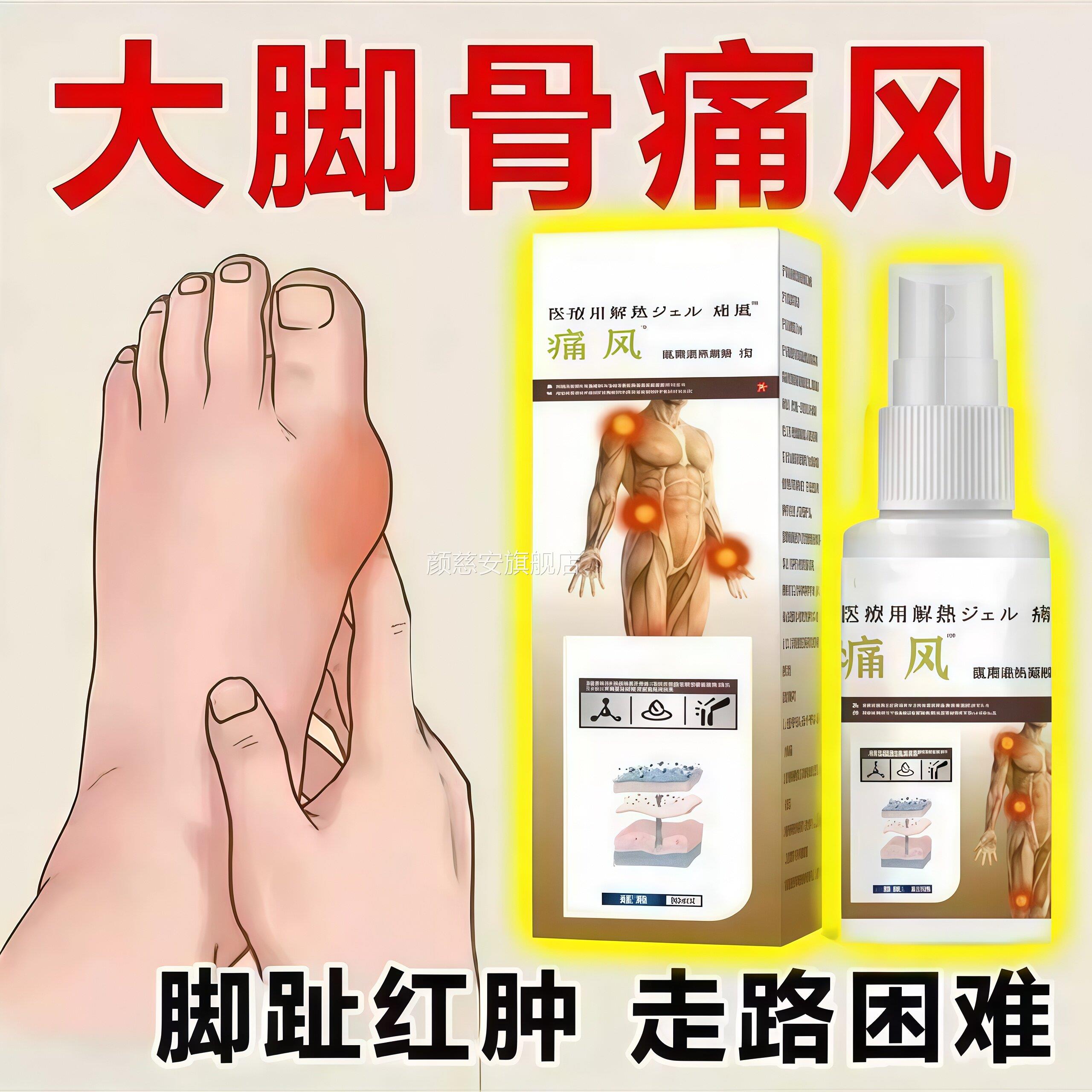 痛风喷雾剂大脚骨痛风脚趾红路肿走困难关节疼痛缓解神器颜慈安旗