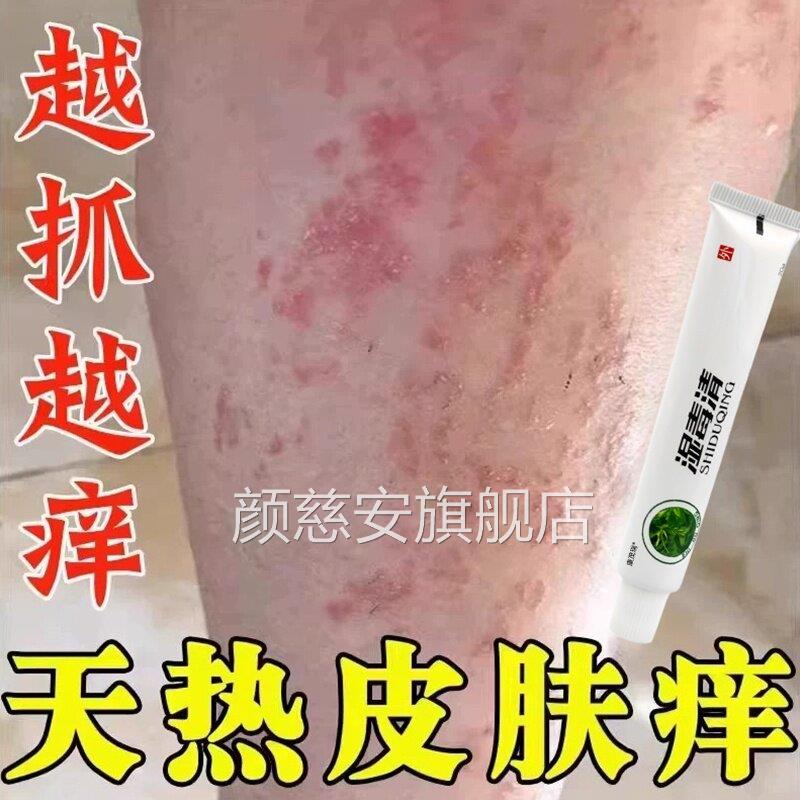 夏天小腿痒湿成人止痒膏出汗身上疙痒天热皮肤痒热瘩红疹热毒颜慈