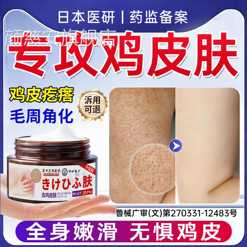 鸡皮肤疙瘩毛囊角胳化症专角质去除神器全身手臂腿膊上的小疙瘩颜