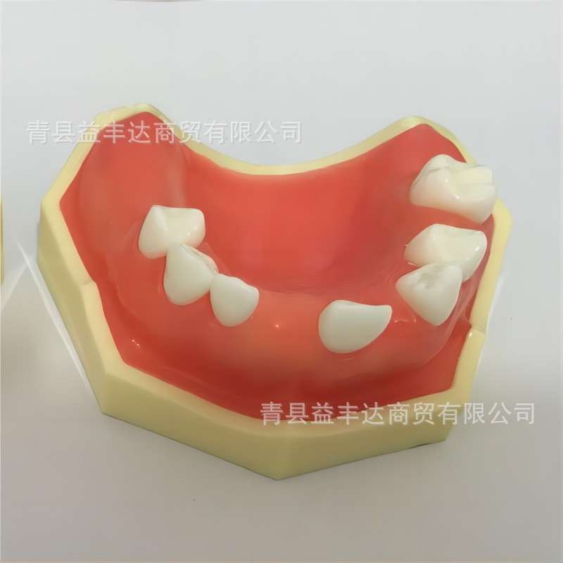 外贸产品种植练习模型 种植牙缺失模型 牙齿种植模型