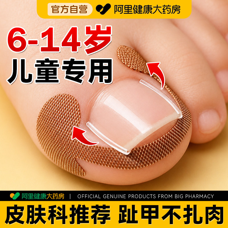 甲沟嵌甲矫正器炎儿童指甲贴趾甲纠正器正甲贴片卷甲专用正甲垫片