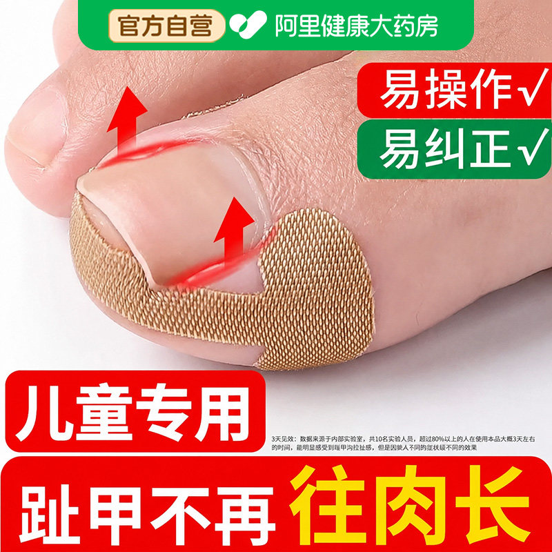 正甲贴片儿童甲沟嵌甲矫正脚指甲纠正器甲沟专用矫正贴脚趾甲沟炎