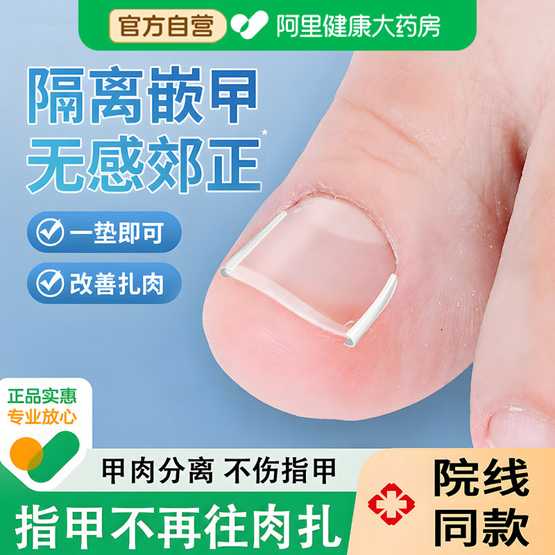 甲沟矫正器嵌甲矫正器脚趾甲卷指甲纠正神器正甲垫拉拉炎正甲贴片