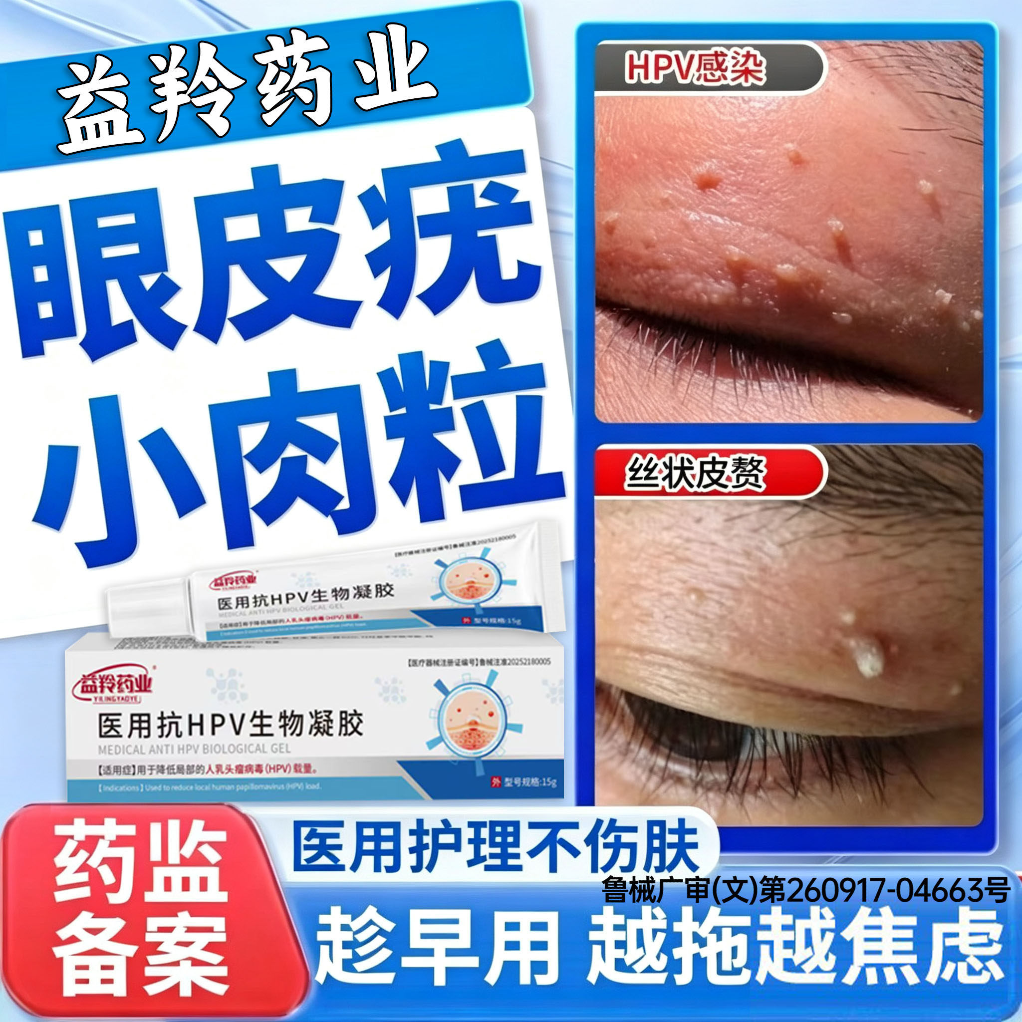 眼皮上长小肉粒医用祛疣瘊丝状疣扁平疣专用去除膏一抹灵面颈部PP