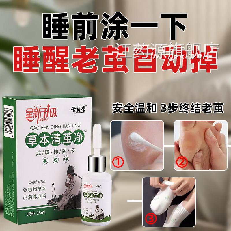 老茧去除软化剂手茧关节茧脚茧脚掌脚后跟去厚硬皮茧鸡垫膏眼神器