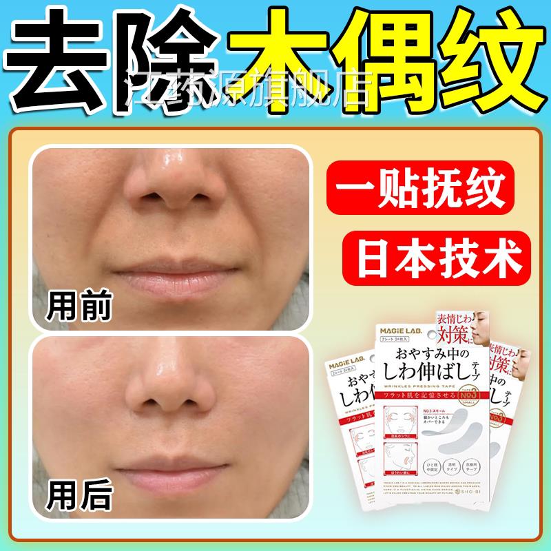 木偶纹贴去除法令纹除神器日本提拉淡化抚皱侧消睡觉专用防表情贴