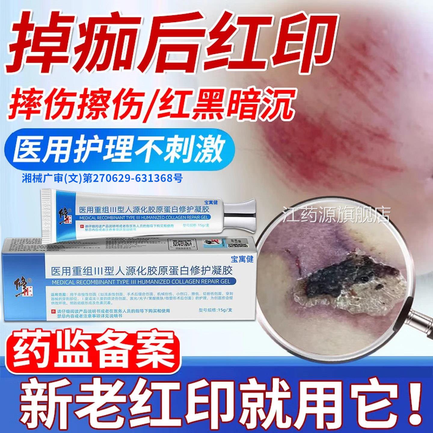 擦伤摔疤痕修复除疤膏去除去疤伤印去黑色素沉淀祛疤膏淡化疤痕江