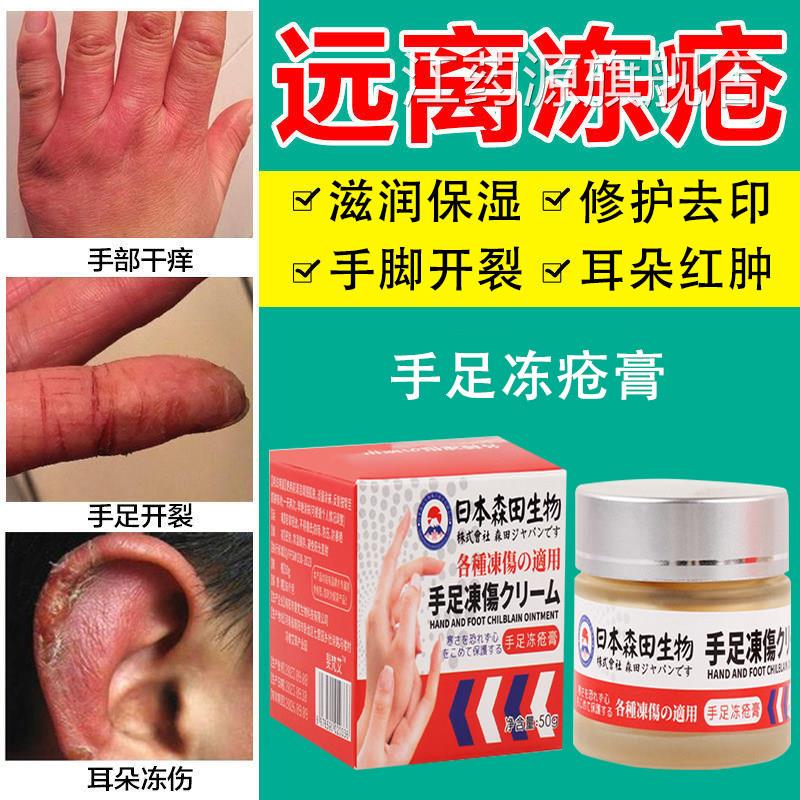 冻肿疮膏止痒冻伤膏药正品防裂膏防冻冻手足耳朵红痒日本特效江药