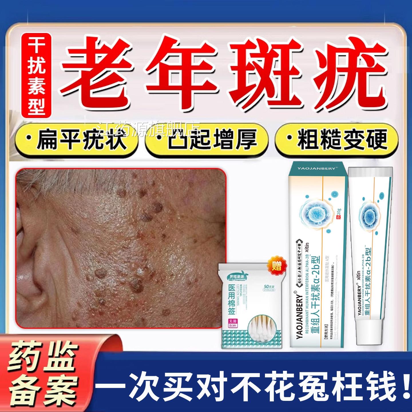 脸上扁平疣专疣老年斑增厚凸起粒疙瘩老人疣老人一抹灵黑斑去除膏