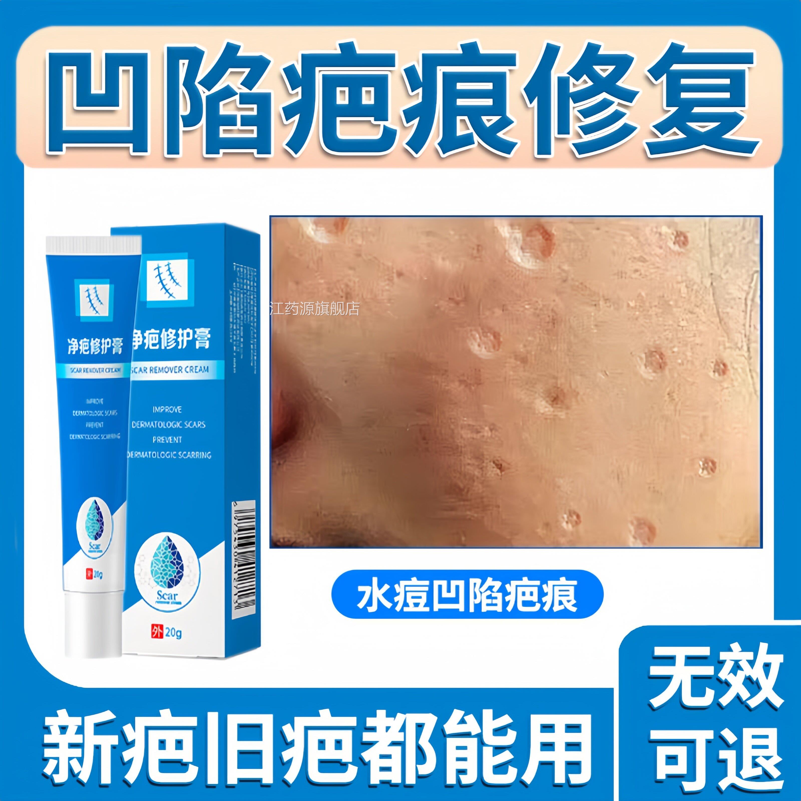 痘凹坑洞修复生长因子去除水痘淡化凹陷疤痕去痘印黑色素沉淀男士