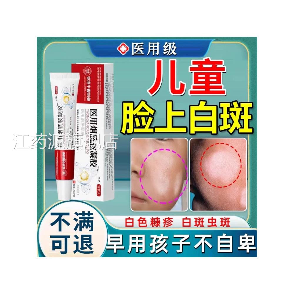 白色糠疹膏儿乳童脸上长白斑维生素e膏儿童医用烟酰胺江药源旗舰图片