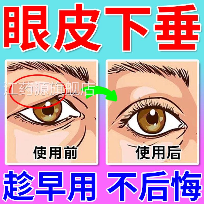 眼皮垂提拉眼贴防松弛撑上双眼皮贴眼泡消肿中老年专用下神器正品