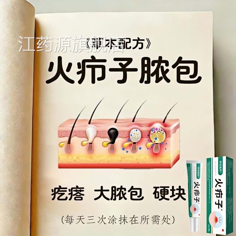 正品火疖子脓包坐板火疙瘩硬块红肿疮发焱头皮毛囊硬疙瘩毛囊净膏