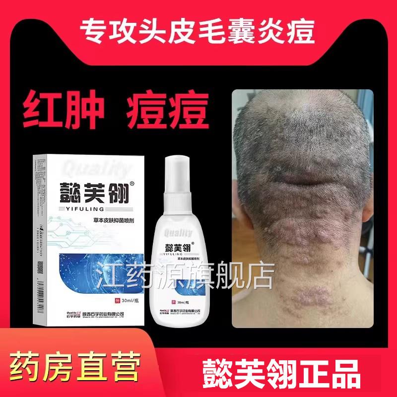 懿芙翎康光号三号喷剂马拉色菌1丹马色拉菌毛囊炎喷雾头皮3专用WY