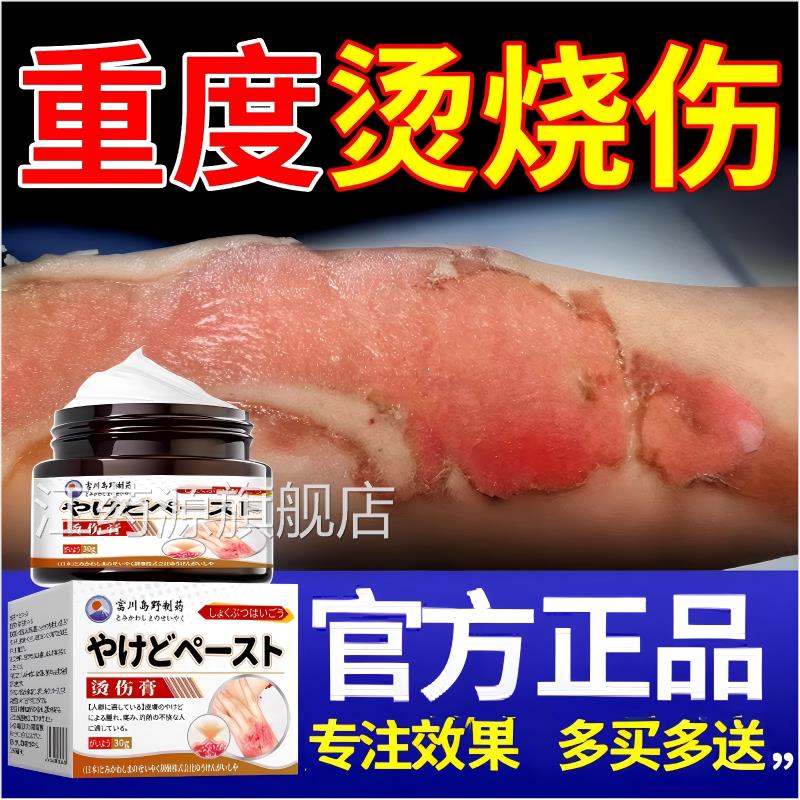 日本痕湿润烧烫伤膏热油开水烫疤外用皮肤烧伤宝正品灼伤溃烂红肿