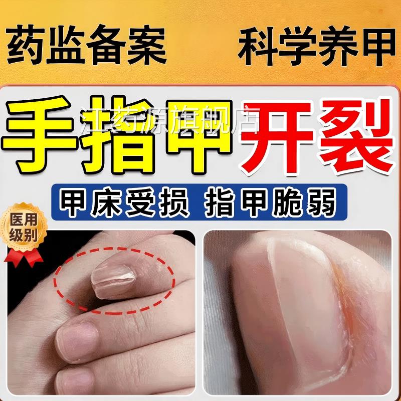手脚趾甲指甲裂开修复断裂劈纹裂竖开裂受损再生养甲床修复液正品