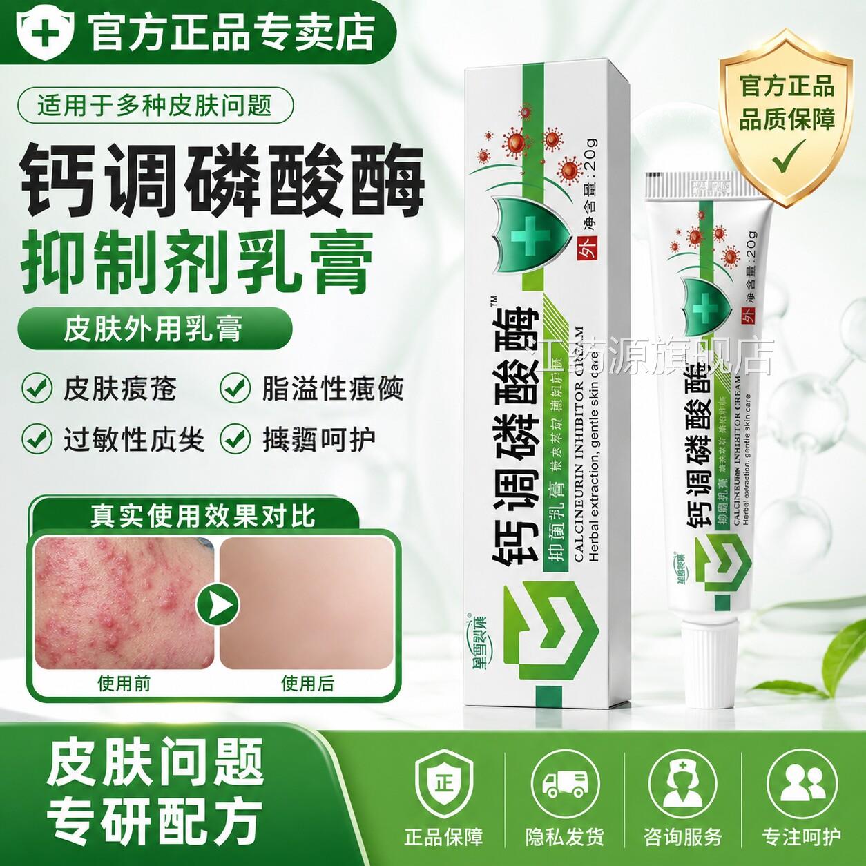 钙调磷酸酶抑制剂乳膏皮肤痤疮旗脂溢性瘙痒过敏性抑菌乳膏官方舰