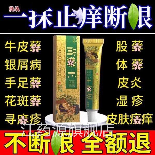 苗藓王药膏头皮股藓藓屑病皮肤杀菌牛藓专用止痒官方银正品官方江