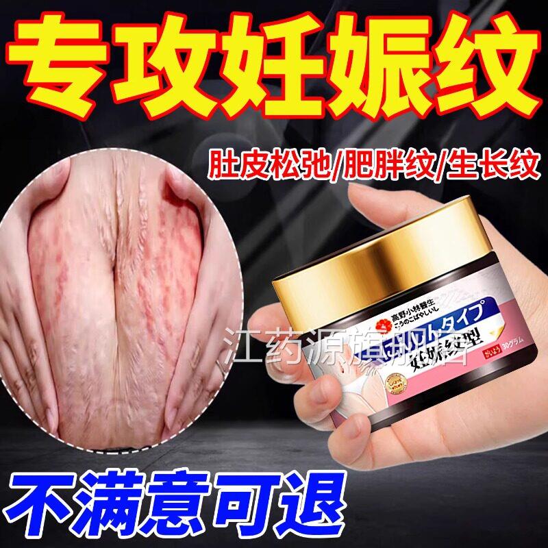 去肥胖纹修复霜消生长纹大腿学生青除少年专用去妊辰娠纹修复膏江