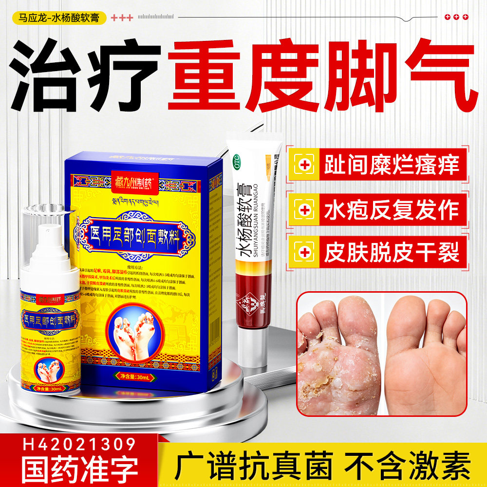 香港脚丫子痒烂脚丫脚出汗脚臭止汗治疗脚气去真菌感染去药专用