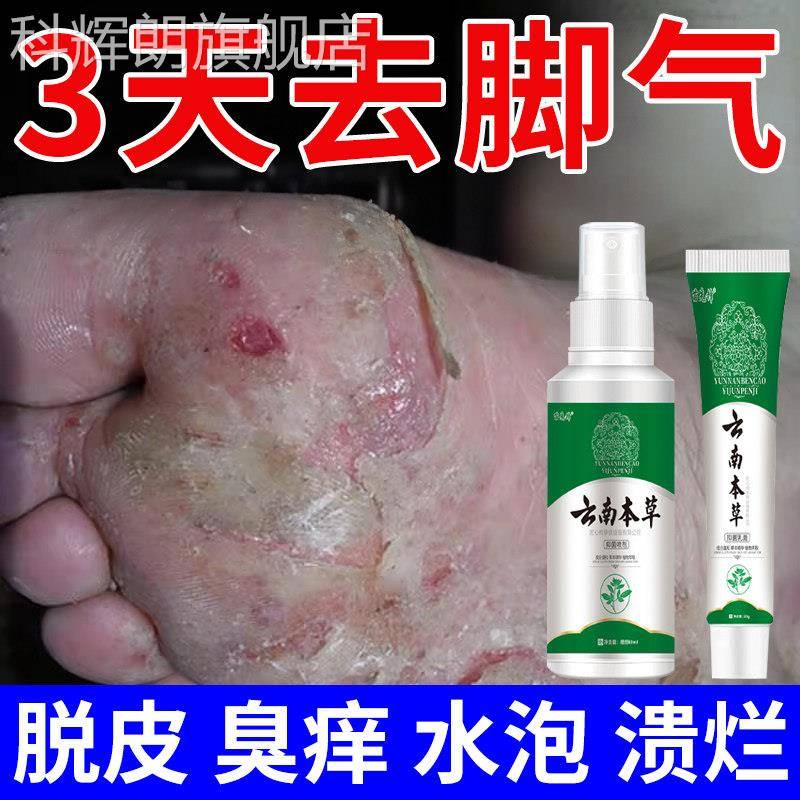 染云南本草脚气喷剂烂脚丫糜烂去脚气止痒脱皮杀菌真菌感专用神器