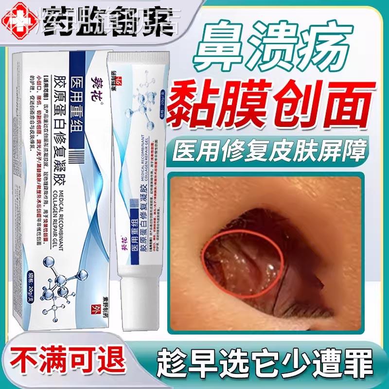 鼻腔黏膜糜烂中隔溃疡修复上火干鼻燥性鼻炎鼻子生疮结痂凝胶Y7科