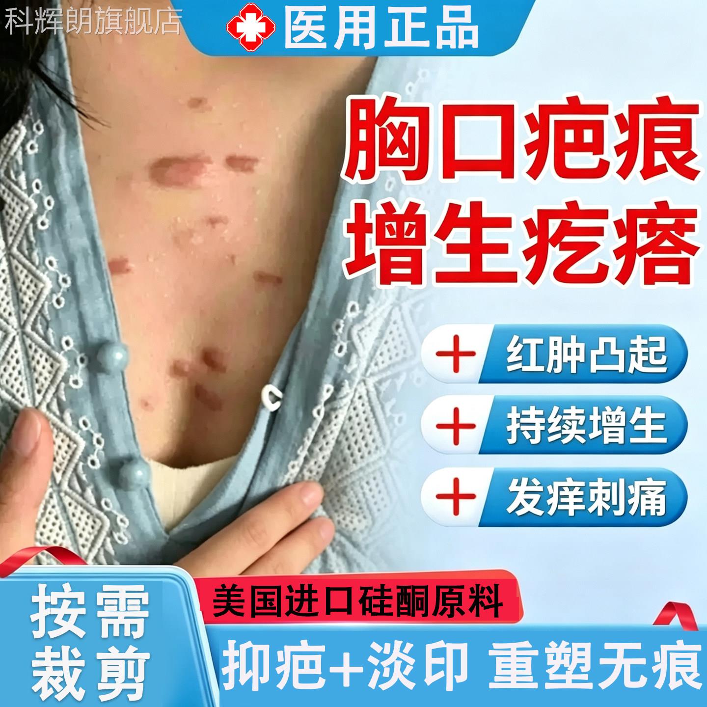 胸前去增生疤痕凸起硬肉去除疙瘩贴止痒医用疤瘢痕压力贴遮祛贴TK