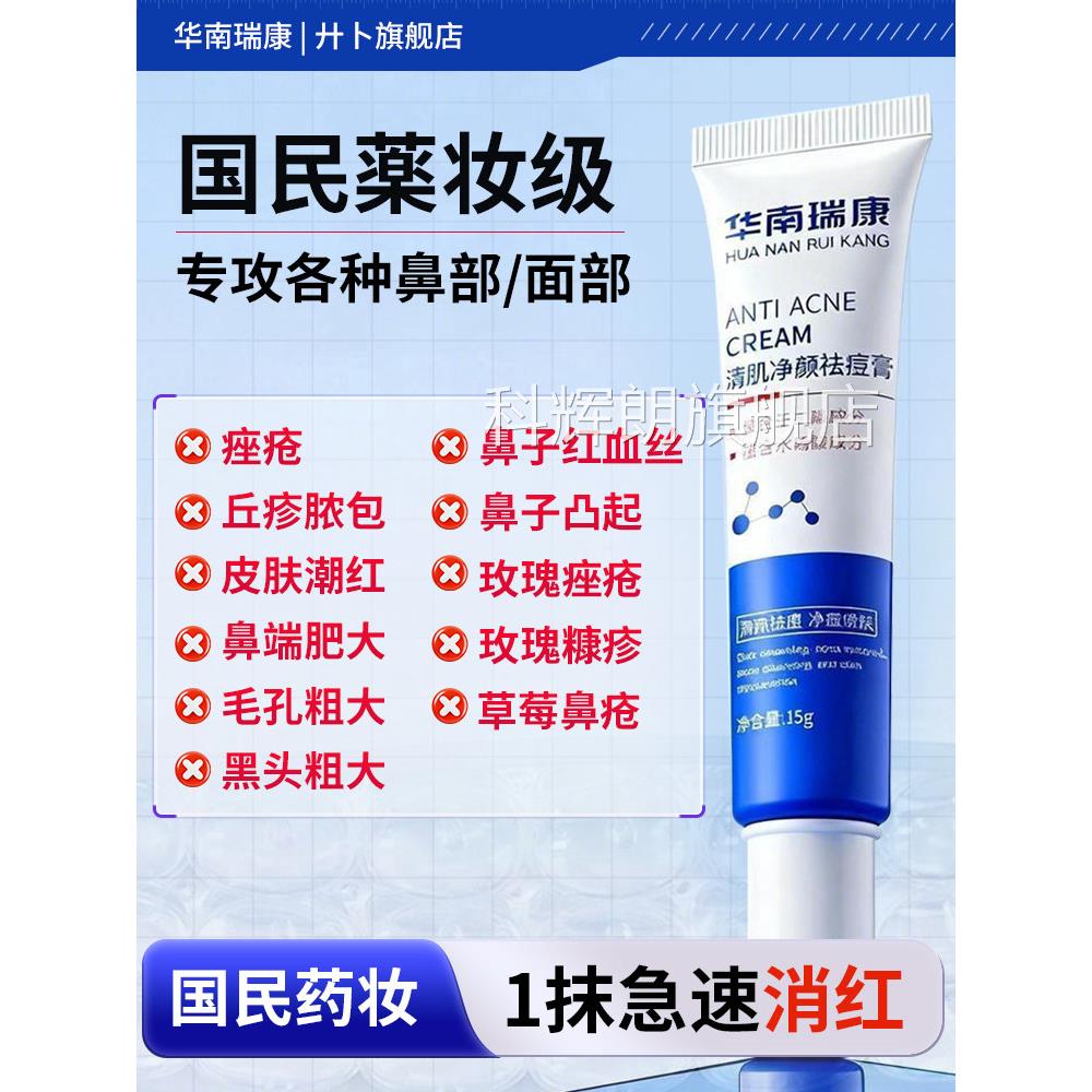 治疗红鼻子酒糟鼻药膏玫瑰痤疮鼻翼两侧泛红药莓鼻修复凝胶消草炎