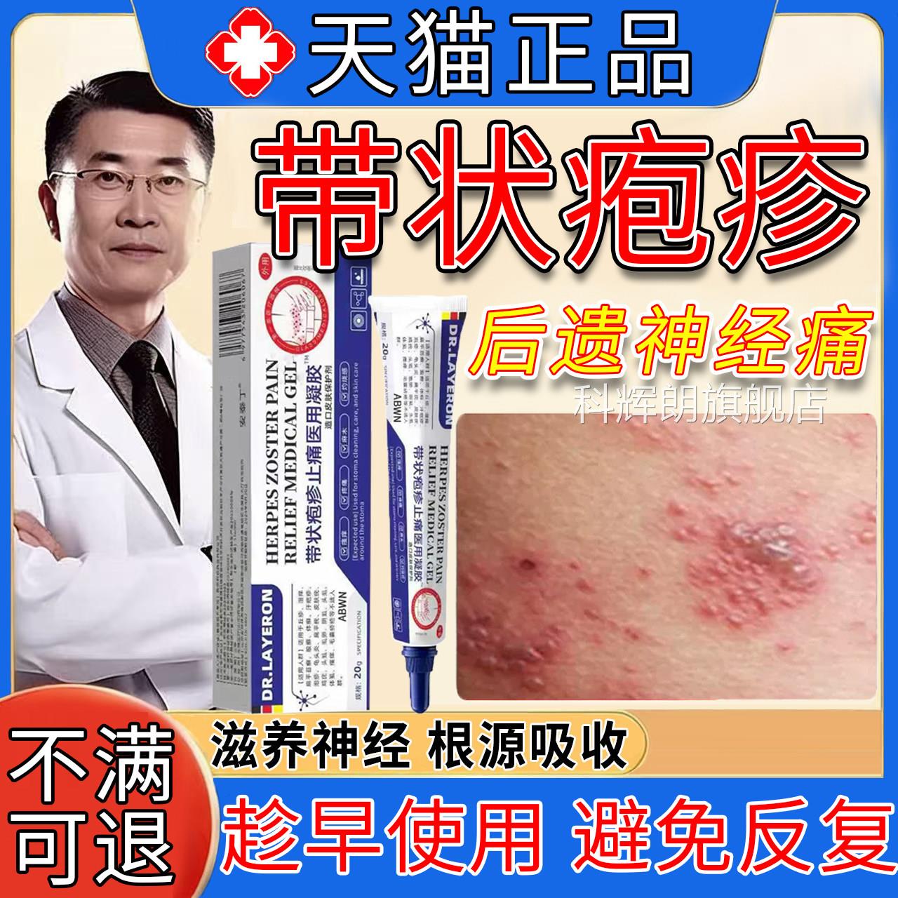 带状疱疹后遗症神经痛特药效蛇盘疮专外用膏快速止痒治刺灼热痛根
