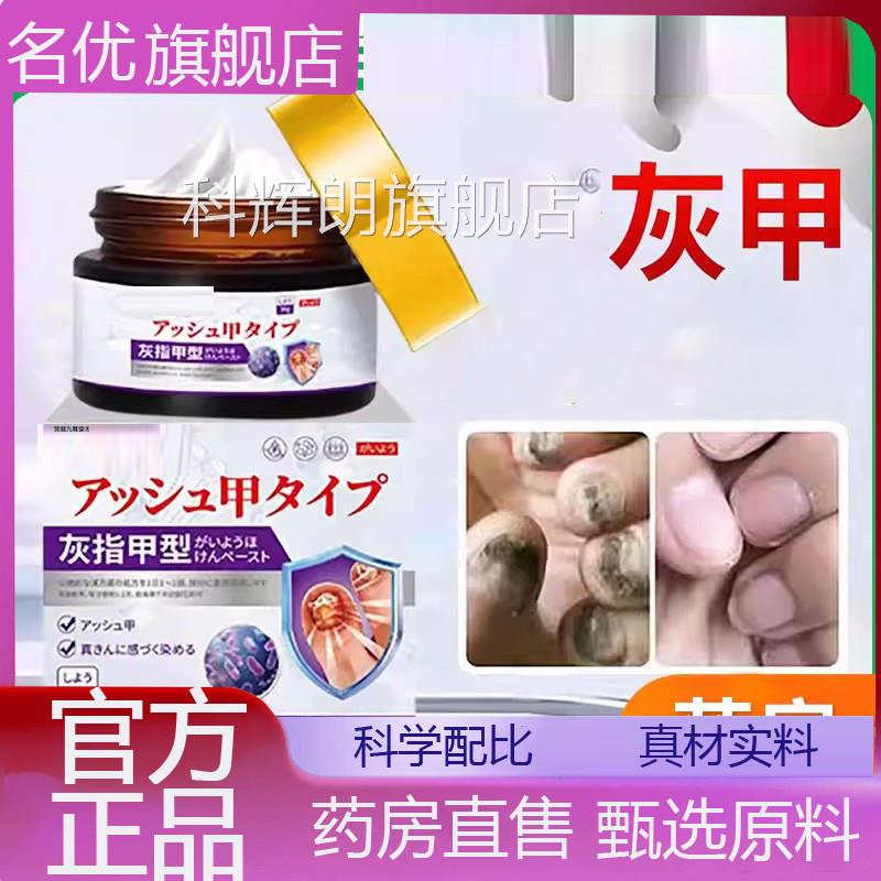 苦参膏灰指甲膏官方品灰甲膏正抑膏外用涂抹膏草本萃取药房款1eq